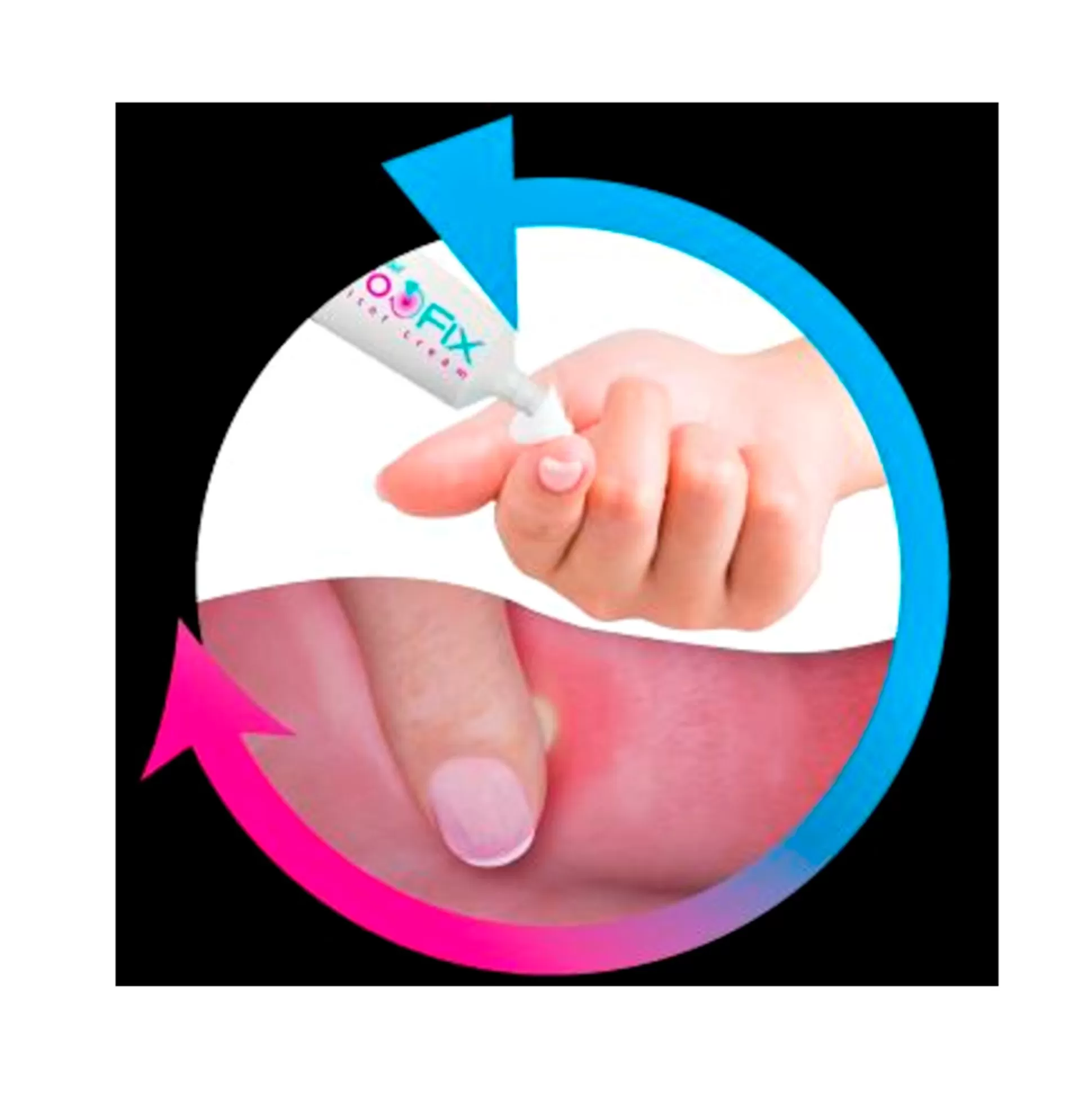 Aphtofix Plus de MEDOSAN - Solution Express contre les Aphtes et Irritations Buccales | Soin Intensif avec Apaisement Immédiat